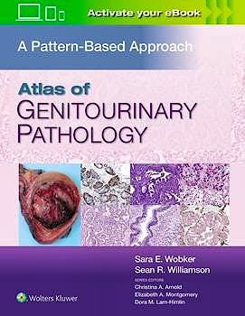 Atlas of Genitourinary Pathology. A Pattern-Based Approach
