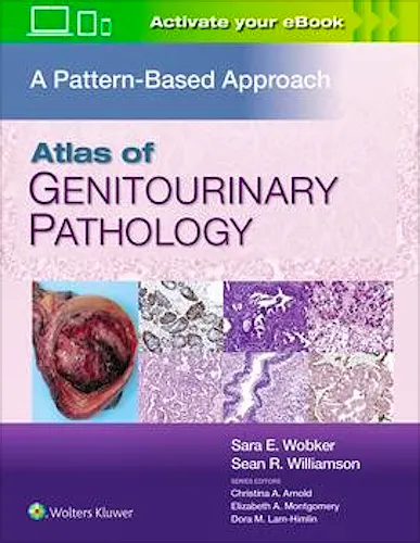 Atlas of Genitourinary Pathology. A Pattern-Based Approach