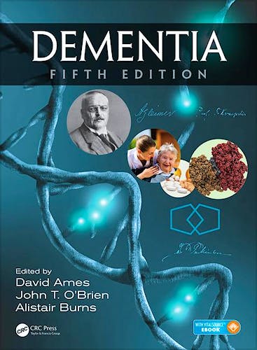 Portada del libro 9781498703109 Dementia