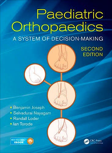 Portada del libro 9781498708401 Paediatric Orthopaedics. A System of Decision-Making