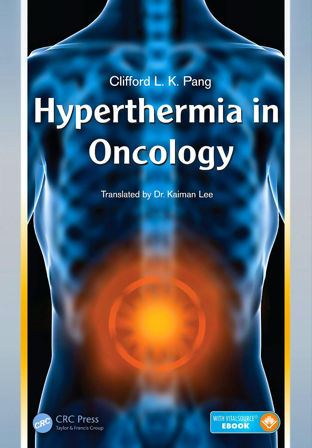 Portada del libro 9781498714464 Hyperthermia in Oncology