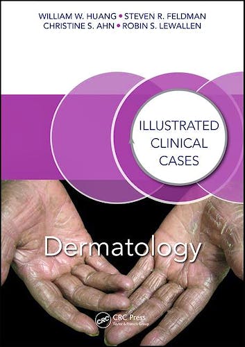 Portada del libro 9781498722889 Dermatology: Illustrated Clinical Cases