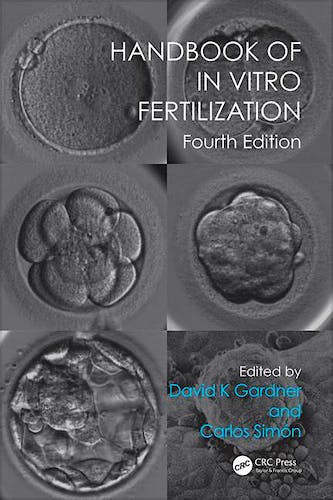 Portada del libro 9781498729390 Handbook of in Vitro Fertilization