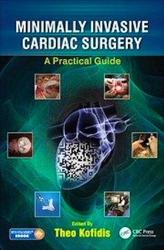 Portada del libro 9781498736466 Minimally Invasive Cardiac Surgery. A Practical Guide