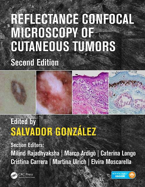 Portada del libro 9781498757607 Reflectance Confocal Microscopy of Cutaneous Tumors (Book + Ebook)