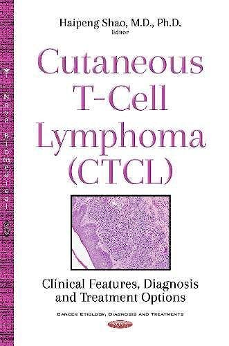 Portada del libro 9781536118995 Cutaneous T-Cell Lymphoma (CTCL). Clinical Features, Diagnosis and Treatment Options