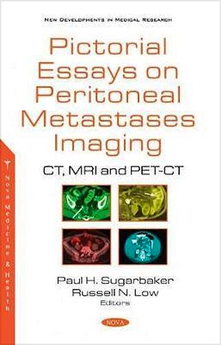 Portada del libro 9781536180145 Pictorial Essays on Peritoneal Metastases Imaging. CT, MRI and PET-CT (New Developments in Medical Research)