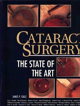 Portada del libro 9781556423628 Cataract Surgery: The State of the Art
