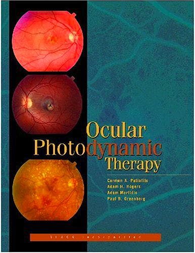 Portada del libro 9781556424908 Ocular Photodynamic Therapy