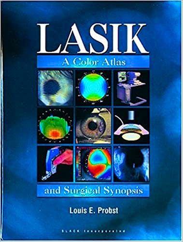 Portada del libro 9781556425240 Lasik: A Color Atlas and Surgical Synopsis