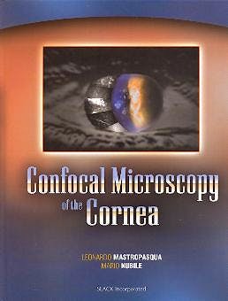 Portada del libro 9781556426117 Confocal Microscopy of the Cornea