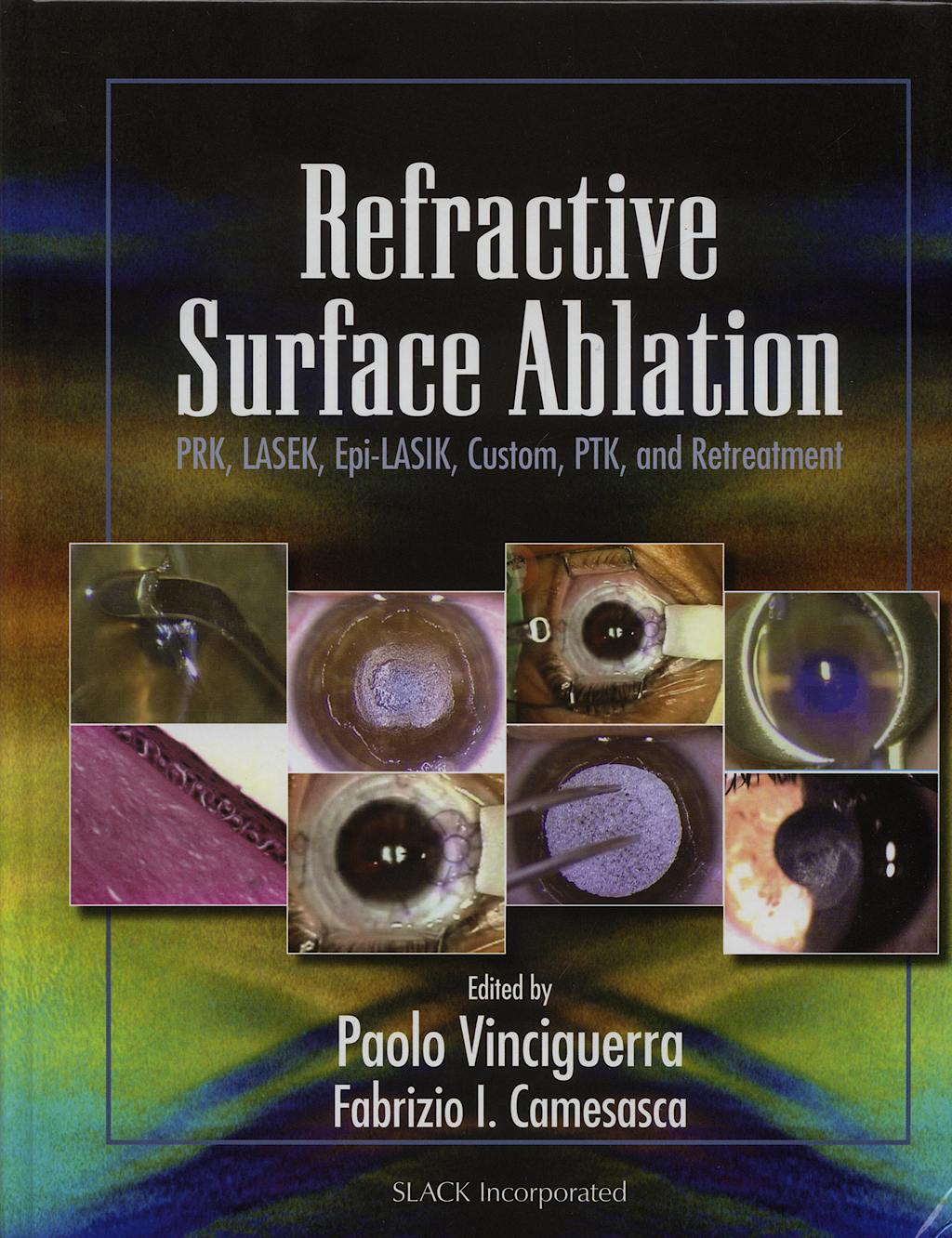 Portada del libro 9781556427138 Refractive Surface Ablation: Prk, Lasek, Epi-Lasik, Custom Ptk and Ret