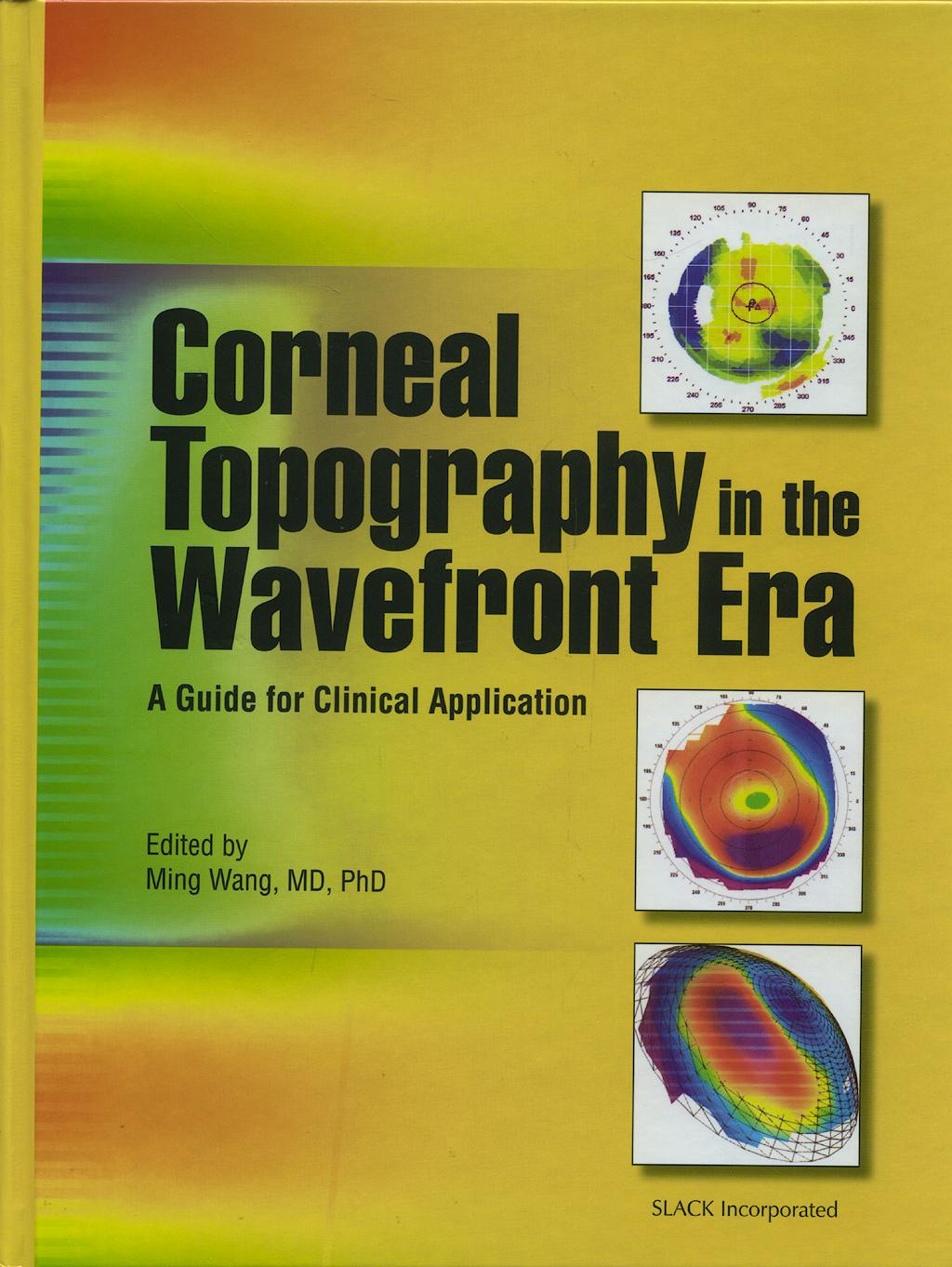 Portada del libro 9781556427183 Corneal Topography in the Wavefront Era