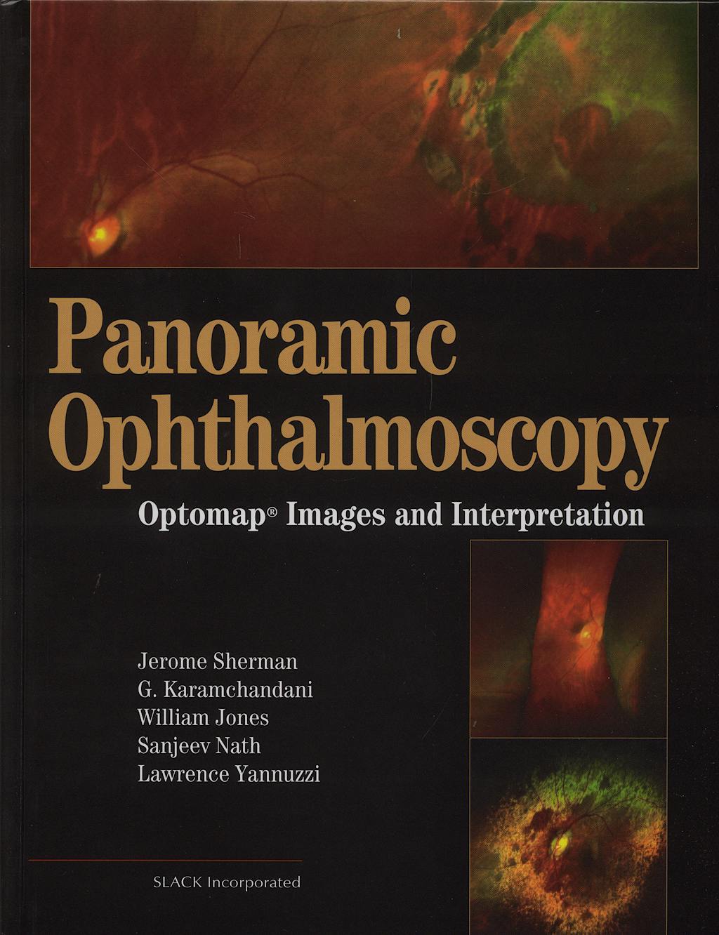 Portada del libro 9781556427800 Panoramic Ophthalmoscopy. Optomap Images And Interpretation