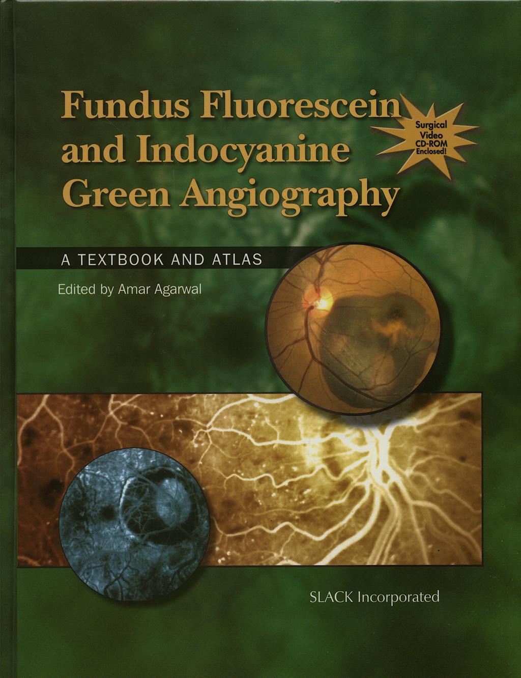 Portada del libro 9781556427879 Fundus Fluorescein and Indocyanine Green Angiography