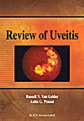 Portada del libro 9781556428227 Review of Uveitis