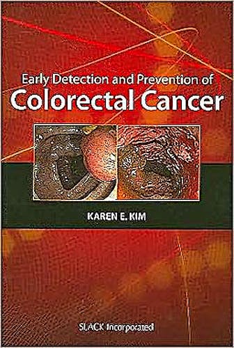 Portada del libro 9781556428371 Early Detection and Prevention in Colorectal Cancer