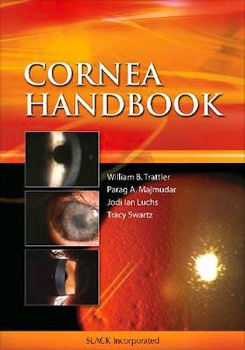 Portada del libro 9781556428425 Cornea Handbook