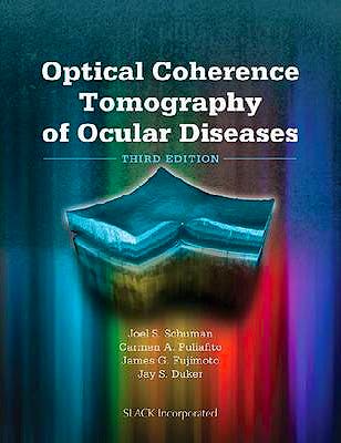Portada del libro 9781556428647 Optical Coherence Tomography of Ocular Diseases