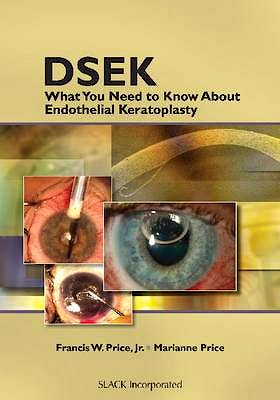 Portada del libro 9781556428814 Dsek. What You Need to Know about Endothelial Keratoplasty