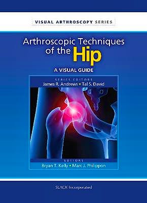 Portada del libro 9781556428869 Arthroscopic Techniques of the Hip. a Visual Guide (Visual Arthroscopy Series)