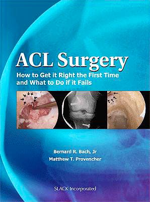 Portada del libro 9781556428951 Acl Surgery. How to Get It Right the First Time and What to Do When Your Surgery Fails