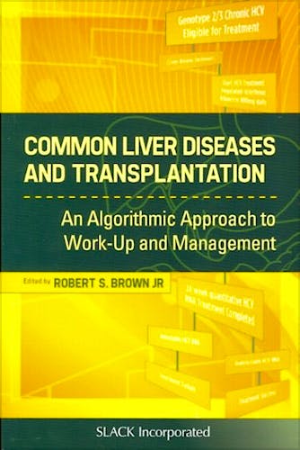 Portada del libro 9781556429033 Common Liver Diseases and Transplantation. an Algoritmic Approach to Work up and Management