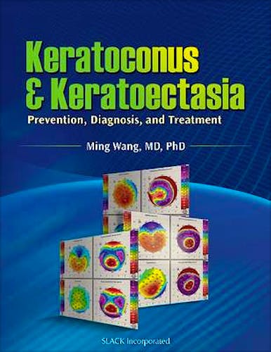 Portada del libro 9781556429132 Keratoconus and Keratoectasia. Prevention, Diagnosis and Treatment