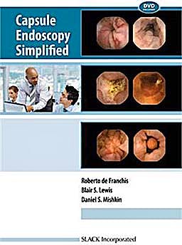 Portada del libro 9781556429408 Capsule Endoscopy Simplified
