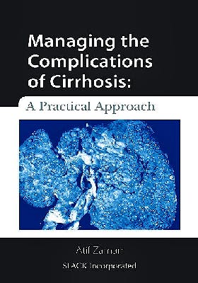 Portada del libro 9781556429576 Managing the Complications of Cirrhosis: A Practical Approach