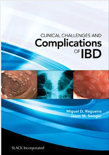 Portada del libro 9781556429804 Clinical Challenges and Complications of IBD