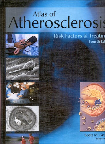 Portada del libro 9781573402248 Atlas of Atherosclerosis. Risk Factors and Treatment