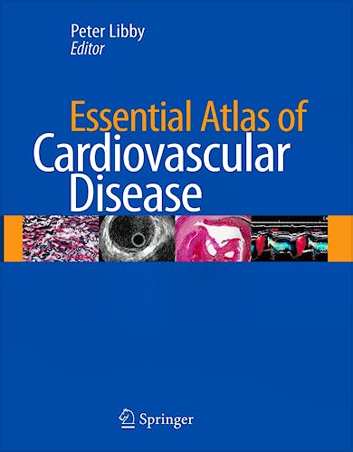 Portada del libro 9781573403092 Essential Atlas of Cardiovascular Disease