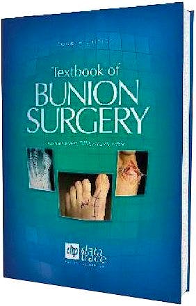 Portada del libro 9781574001419 Textbook of Bunion Surgery