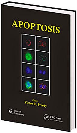 Portada del libro 9781578085835 Apoptosis: Modern Insights into Disease from Molecules to Man