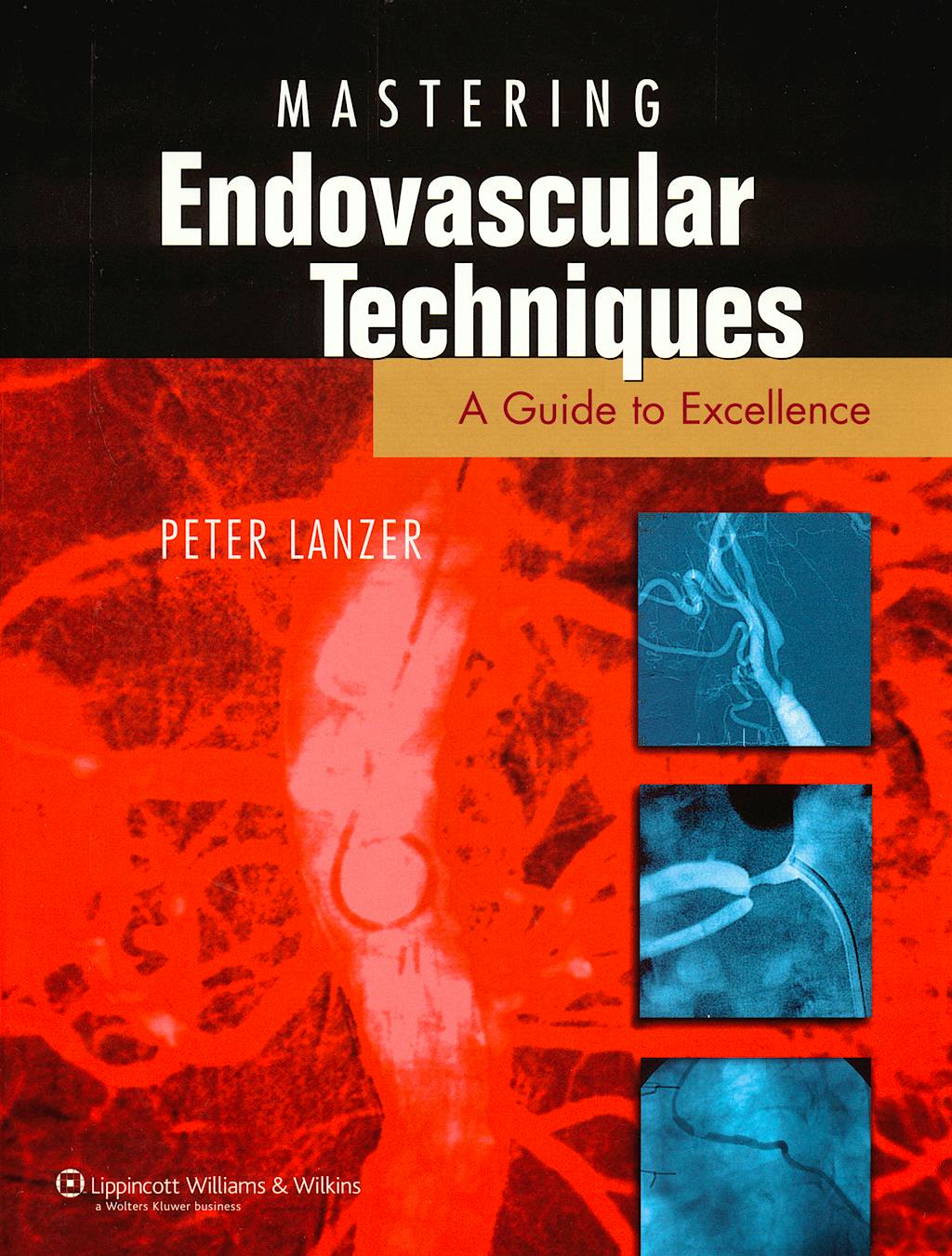 Portada del libro 9781582559674 Mastering Endovascular Techniques. a Guide to Excellence