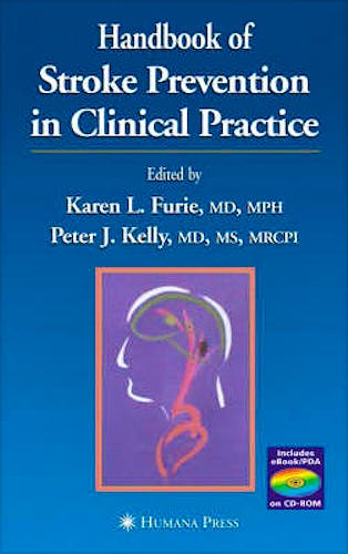Portada del libro 9781588291585 Handbook of Stroke Prevention in Clinical Practice