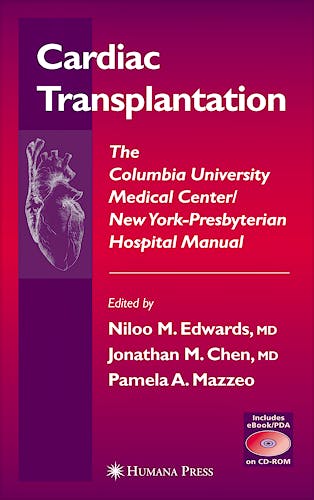 Portada del libro 9781588291813 Cardiac Transplantation: The Columbia University M