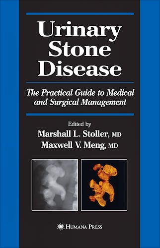 Portada del libro 9781588292193 Urinary Stone Disease
