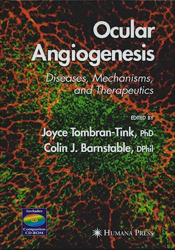 Portada del libro 9781588295149 Ocular Angiogenesis: Diseases, Mechanisms, and Therapeutics + Cd