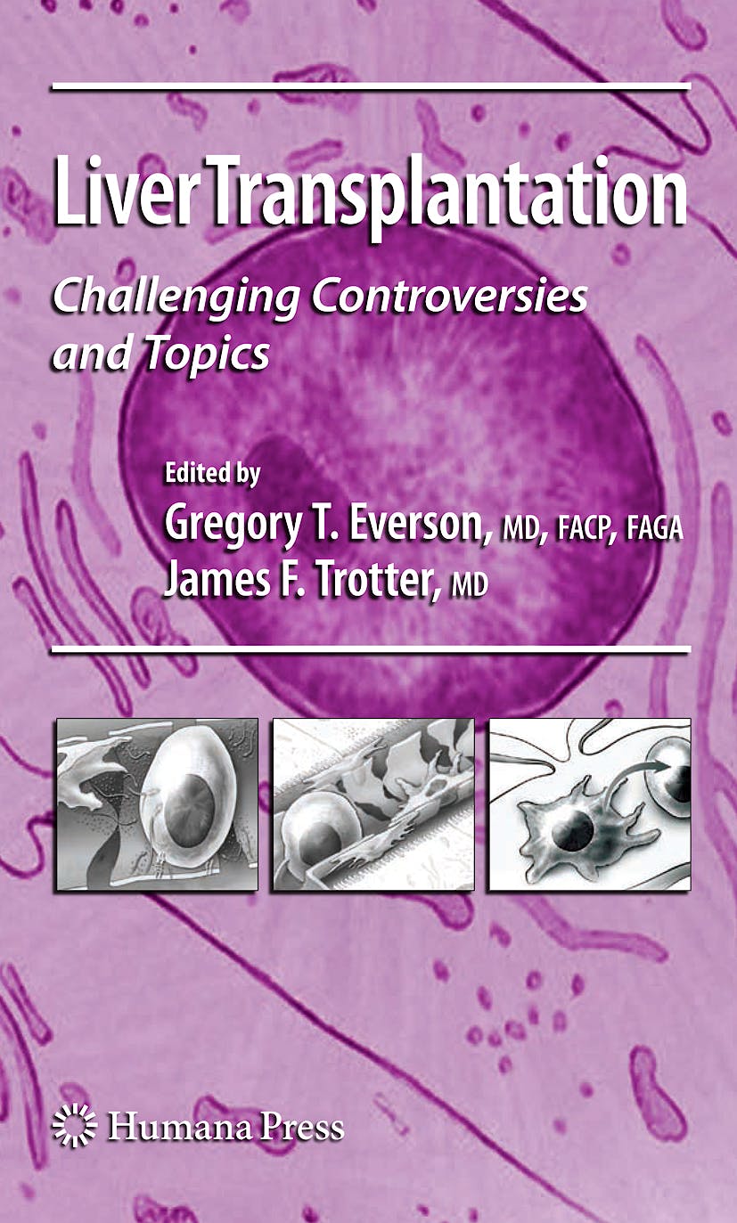 Portada del libro 9781588297938 Liver Transplantation. Challenging Controversies and Topics