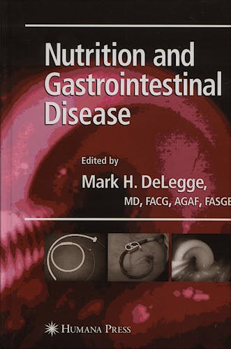 Portada del libro 9781588298089 Nutrition and Gastrointestinal Disease