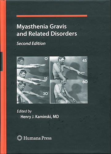 Portada del libro 9781588298522 Myasthenia Gravis and Related Disorders