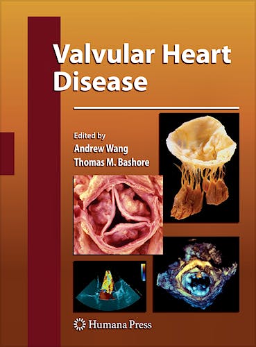 Portada del libro 9781588299826 Valvular Heart Disease