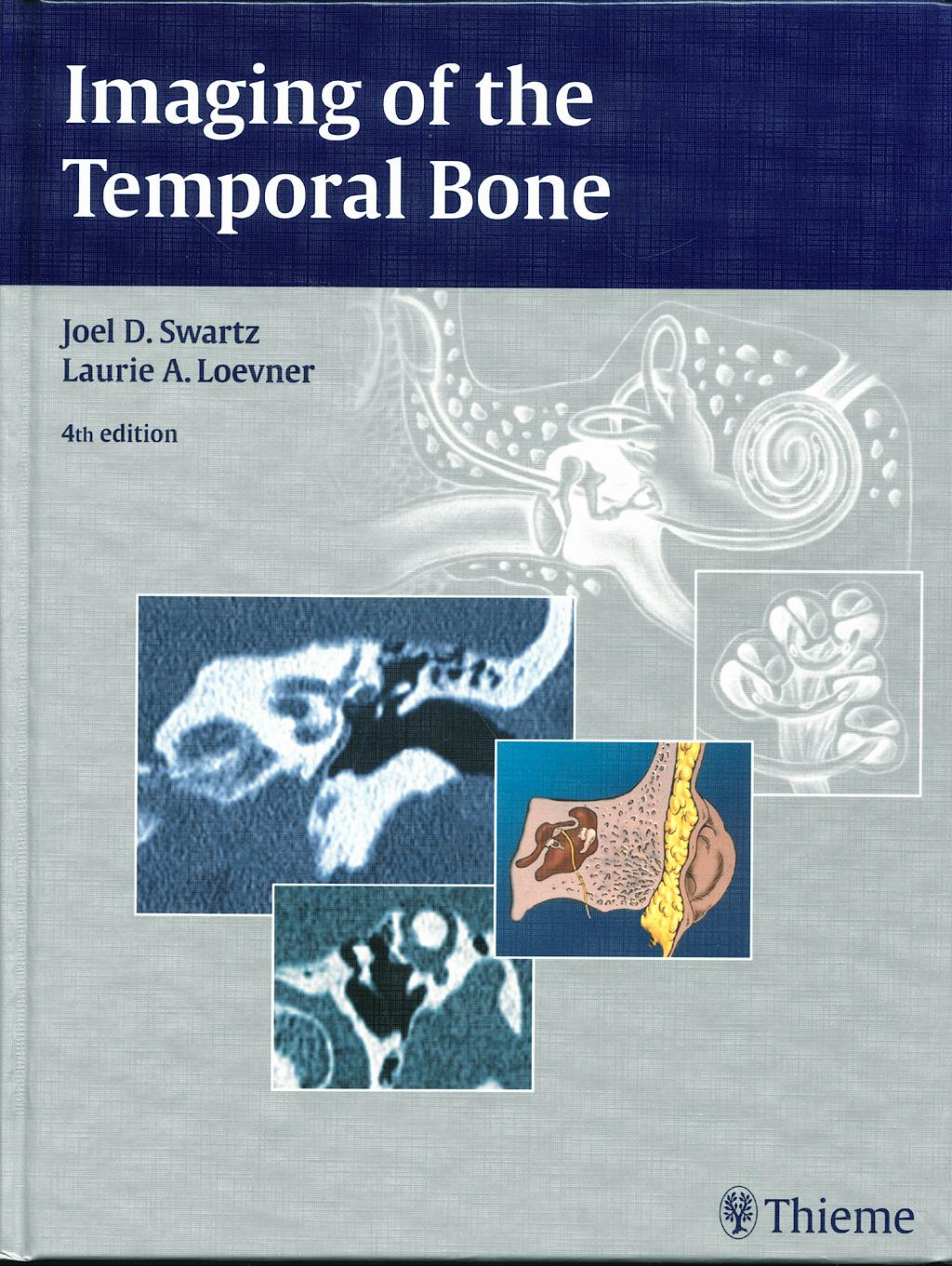 Portada del libro 9781588903457 Imaging of the Temporal Bone