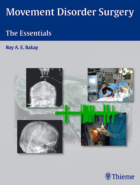 Portada del libro 9781588903976 Movement Disorder Surgery. the Essentials