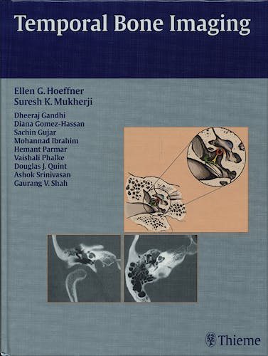 Portada del libro 9781588904010 Temporal Bone Imaging