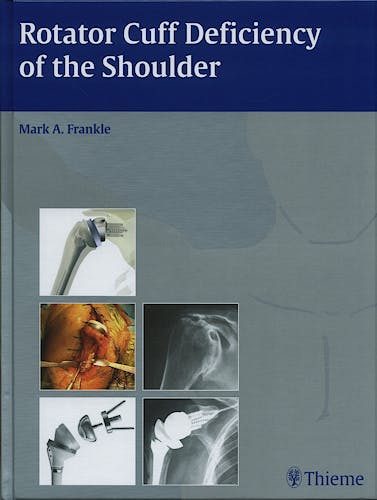 Portada del libro 9781588905062 Rotator Cuff Deficiency of the Shoulder