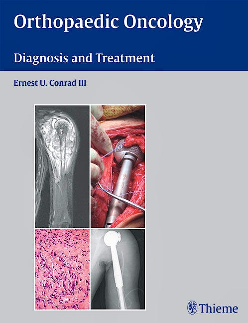 Portada del libro 9781588905239 Orthopaedic Oncology. Diagnosis and Treatment