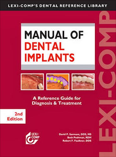 Portada del libro 9781591952503 Manual of Dental Implants. A Reference Guide for Diagnosis and Treatment